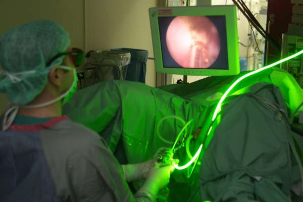 Использование лазерной технологии в лечении эпилепсии в Израиле