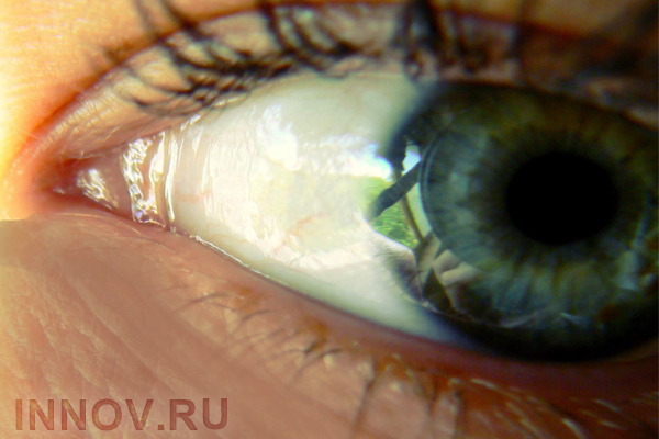 Камера смартфона может обнаружить рак глаза